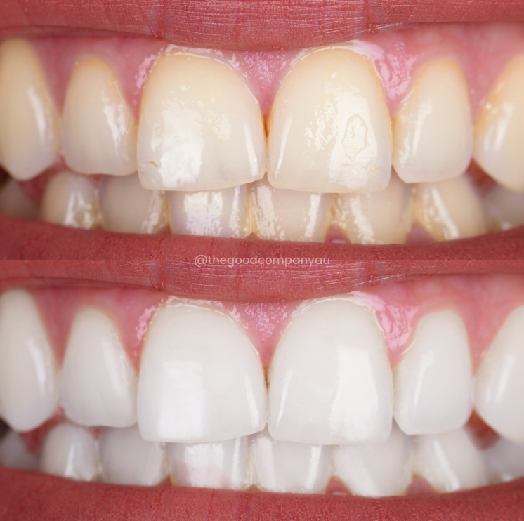 PAP+ Teeth Whitening Mouthwash Drops - The Good Company