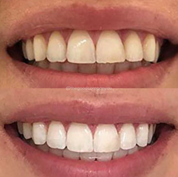 PAP+ Teeth Whitening Mouthwash Drops - The Good Company